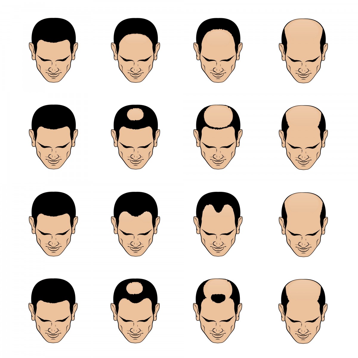 Identifying Baldness